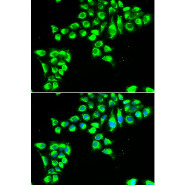 Immunofluorescence - Anti-Claudin 2 Antibody (A9915) - Antibodies.com