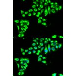 Immunofluorescence - Anti-Claudin 2 Antibody (A9915) - Antibodies.com
