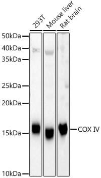 Western blot analysis of extracts of various cell lines, using Anti-COX4I1 Antibody (A6564) at 1:1,000 dilution.
Secondary antibody: Goat Anti-Rabbit IgG (H+L) (HRP) (AS014) at 1:10,000 dilution.
Lysates / proteins: 25µg per lane.
Blocking buffer: 3% non-fat dry milk in TBST.
Detection: ECL Basic Kit (RM00020).
Exposure time: 15s.