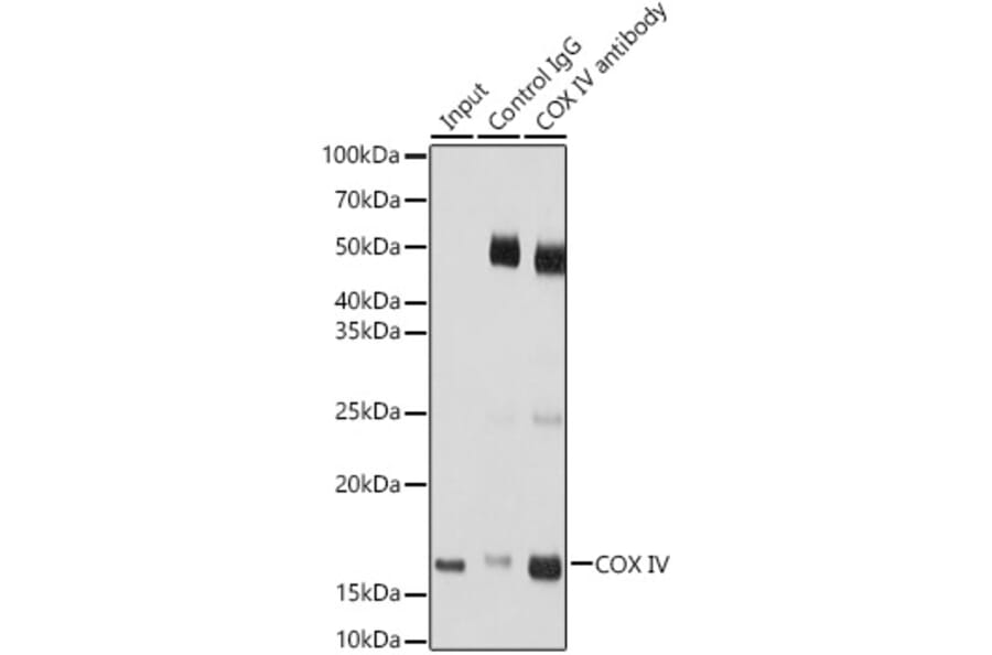 Western Blot - Anti-COX IV Antibody (A9916) - Antibodies.com