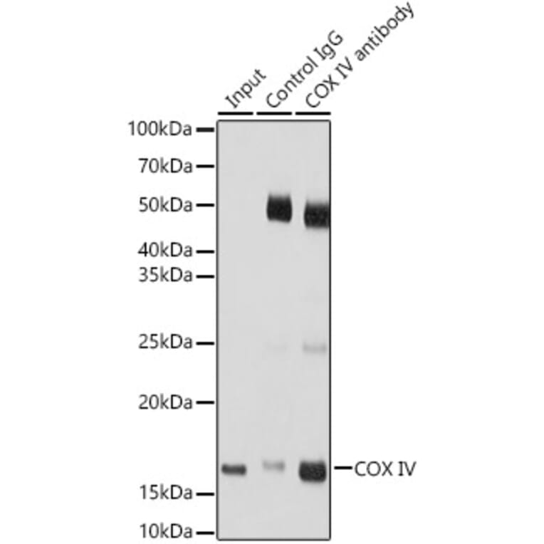 Western Blot - Anti-COX IV Antibody (A9916) - Antibodies.com
