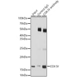 Western Blot - Anti-COX IV Antibody (A9916) - Antibodies.com