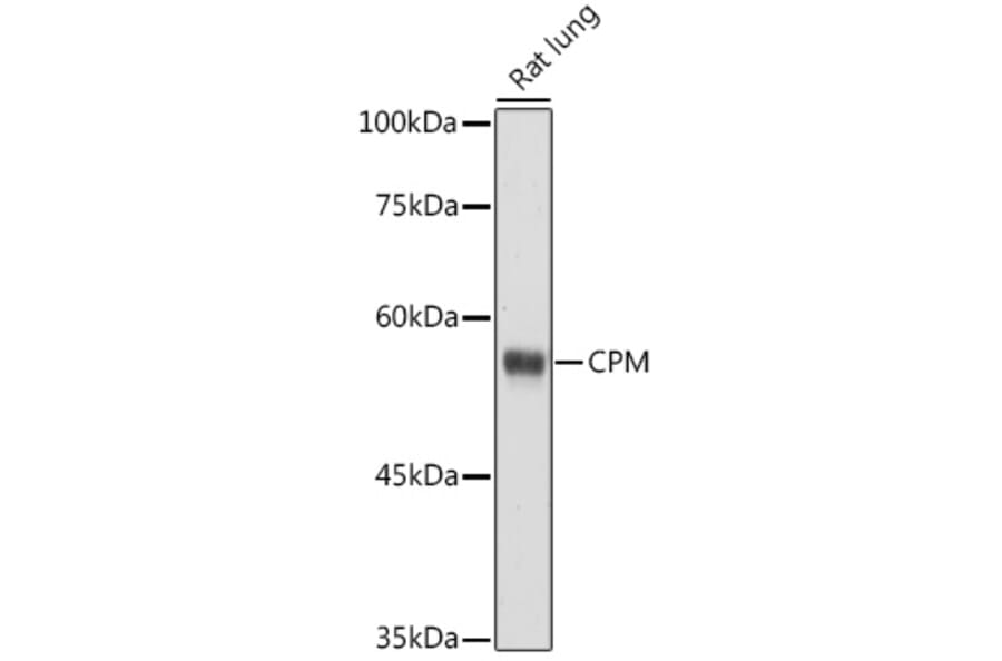 Western Blot - Anti-CPM Antibody (A9917) - Antibodies.com