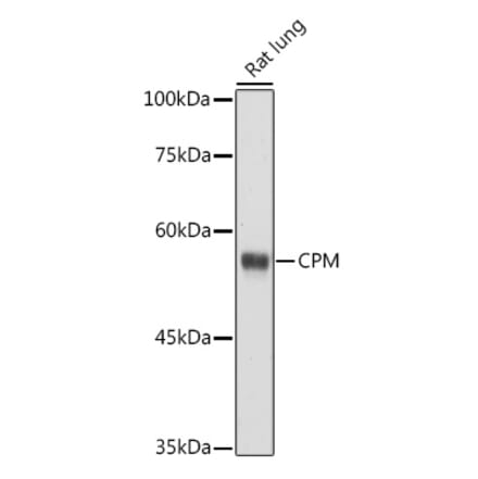 Western Blot - Anti-CPM Antibody (A9917) - Antibodies.com