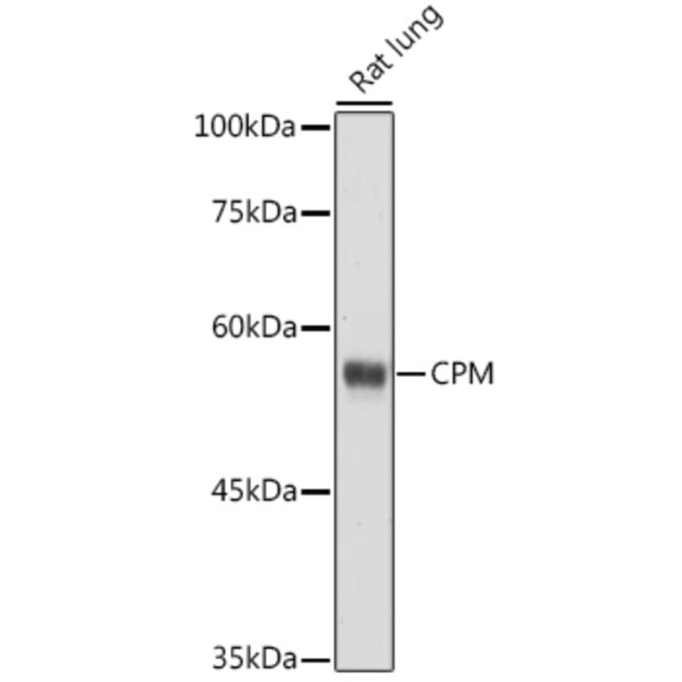 Western Blot - Anti-CPM Antibody (A9917) - Antibodies.com