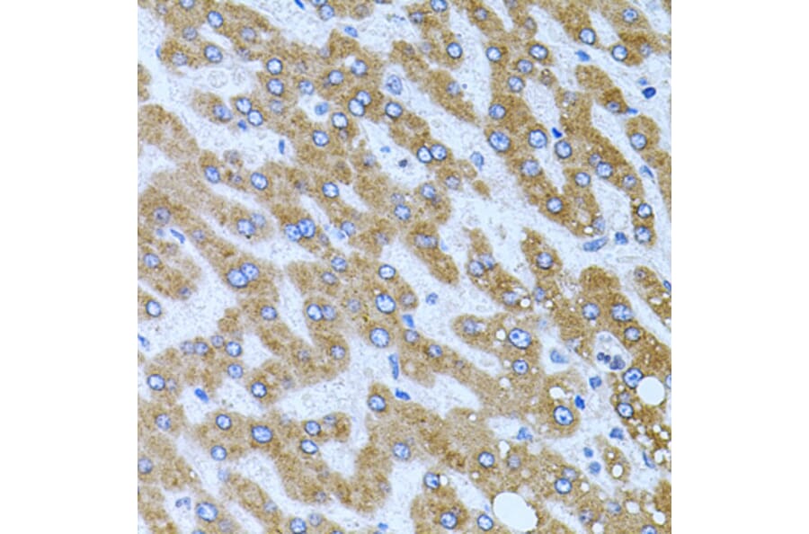 Immunohistochemistry - Anti-CPM Antibody (A9917) - Antibodies.com