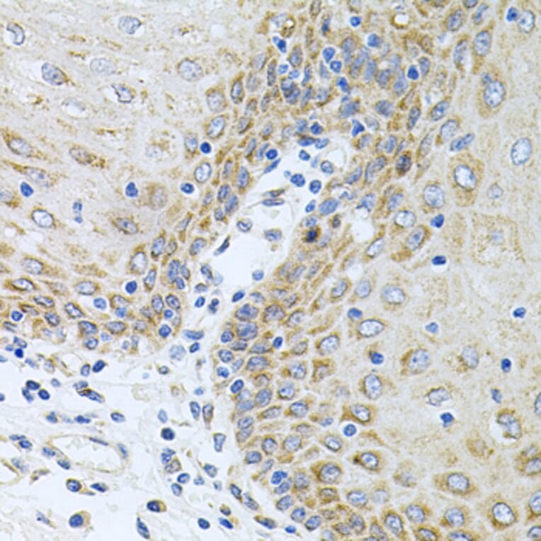 Immunohistochemistry - Anti-CPM Antibody (A9917) - Antibodies.com