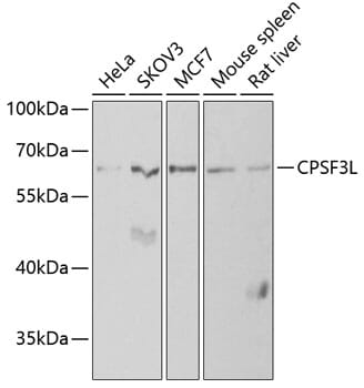 Western blot analysis of extracts of various cell lines, using Anti-CPSF3L Antibody (A6566) at 1:1,000 dilution.
Secondary antibody: Goat Anti-Rabbit IgG (H+L) (HRP) (AS014) at 1:10,000 dilution.
Lysates / proteins: 25µg per lane.
Blocking buffer: 3% non-fat dry milk in TBST.
Detection: ECL Basic Kit (RM00020).
Exposure time: 90s.