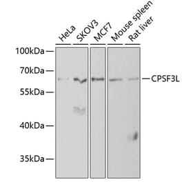 Western Blot - Anti-INTS11 Antibody (A9918) - Antibodies.com