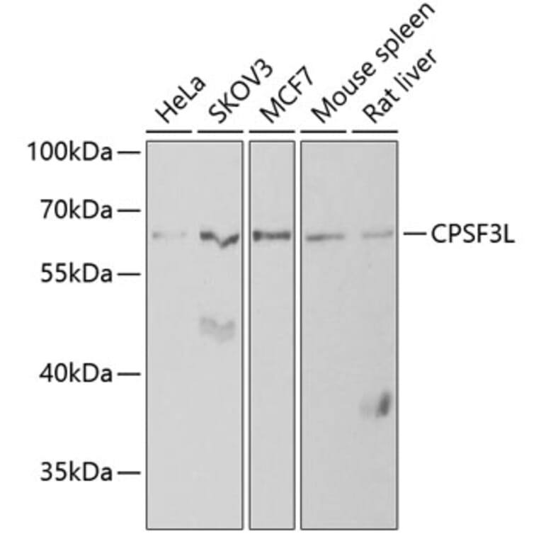 Western Blot - Anti-INTS11 Antibody (A9918) - Antibodies.com