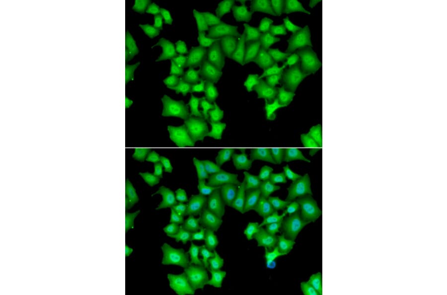 Immunofluorescence - Anti-INTS11 Antibody (A9918) - Antibodies.com