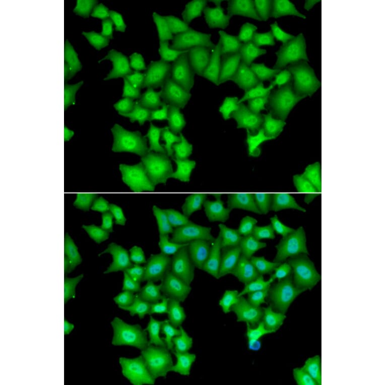 Immunofluorescence - Anti-INTS11 Antibody (A9918) - Antibodies.com