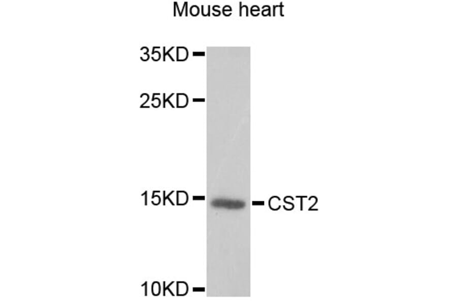 Western Blot - Anti-CST2 Antibody (A6571) - Antibodies.com