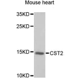 Western Blot - Anti-CST2 Antibody (A6571) - Antibodies.com