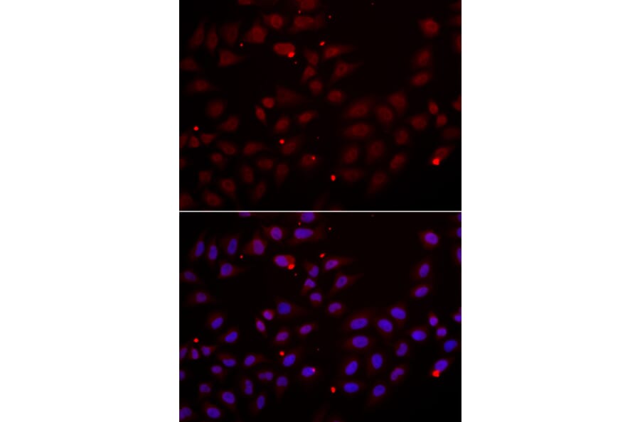 Immunofluorescence - Anti-CST2 Antibody (A6571) - Antibodies.com