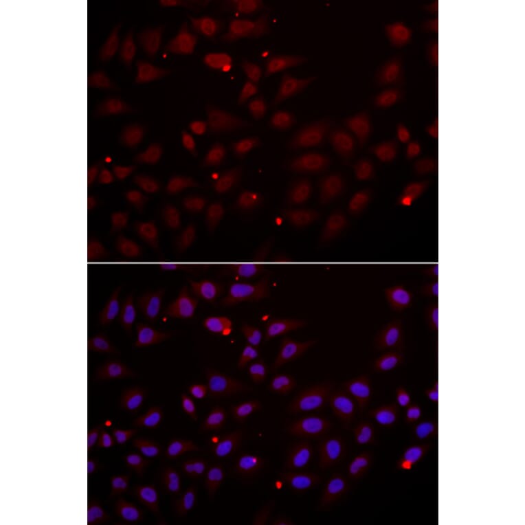Immunofluorescence - Anti-CST2 Antibody (A6571) - Antibodies.com