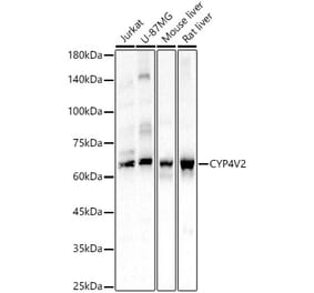 Western Blot - Anti-CYP4V2 Antibody (A9920) - Antibodies.com