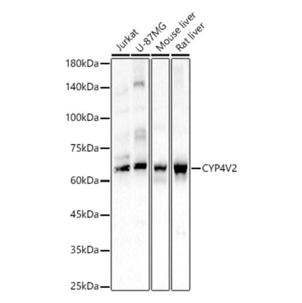 Western Blot - Anti-CYP4V2 Antibody (A9920) - Antibodies.com