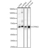 Western Blot - Anti-CYP4V2 Antibody (A9920) - Antibodies.com
