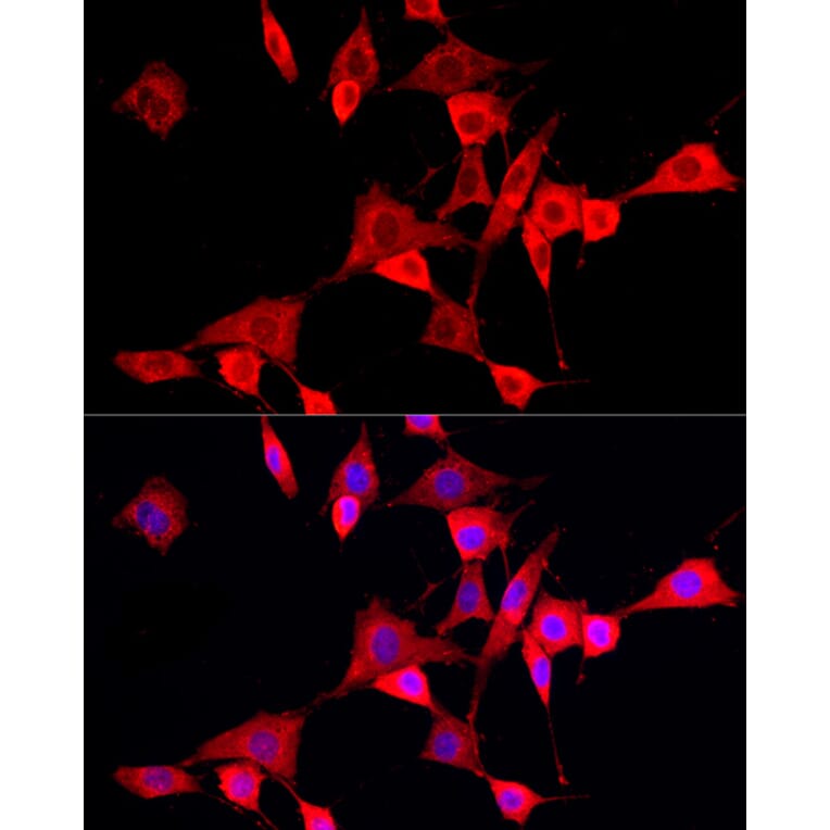 Immunofluorescence - Anti-CYP4V2 Antibody (A9920) - Antibodies.com