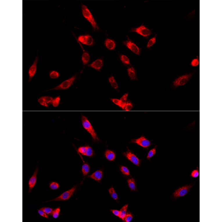 Immunofluorescence - Anti-CYP4V2 Antibody (A9920) - Antibodies.com