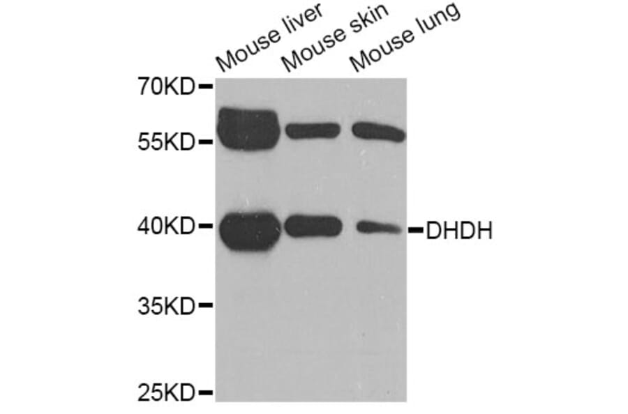 Western Blot - Anti-DHDH Antibody (A6577) - Antibodies.com