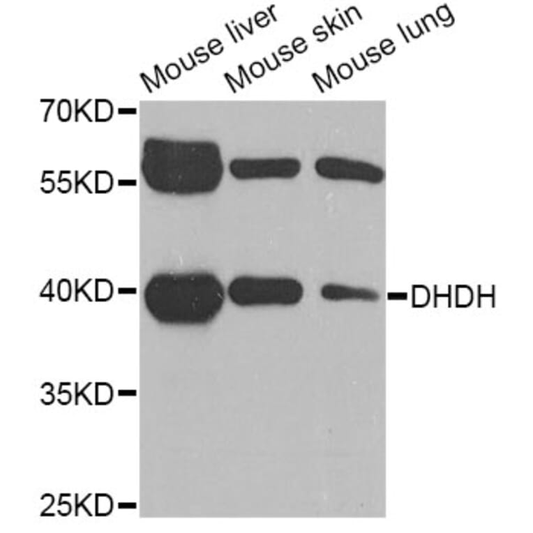 Western Blot - Anti-DHDH Antibody (A6577) - Antibodies.com