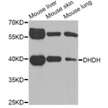 Western Blot - Anti-DHDH Antibody (A6577) - Antibodies.com