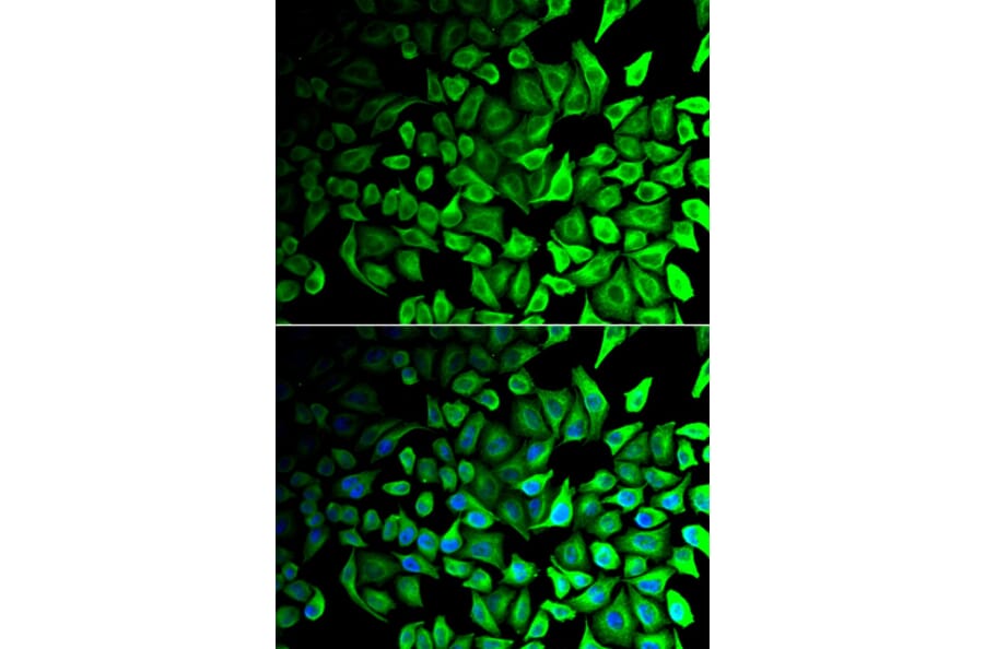 Immunofluorescence - Anti-DPP7 Antibody (A6579) - Antibodies.com