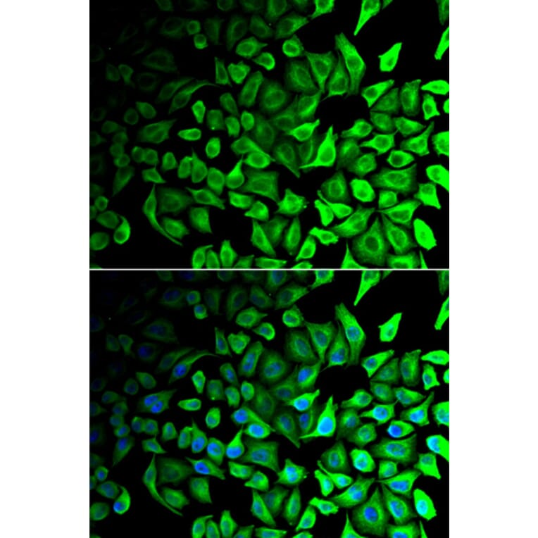 Immunofluorescence - Anti-DPP7 Antibody (A6579) - Antibodies.com