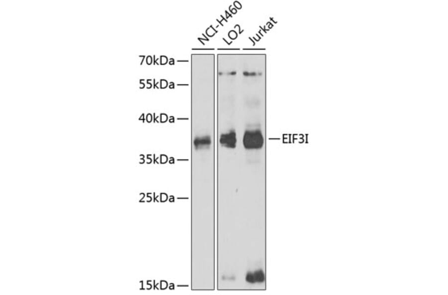 Western Blot - Anti-EIF3I Antibody (A6582) - Antibodies.com