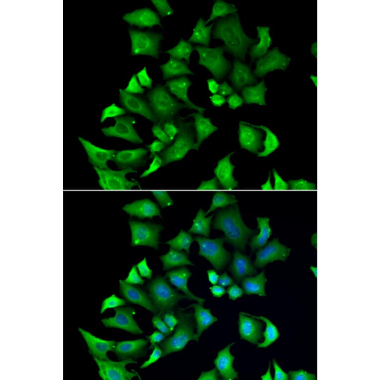 Immunofluorescence - Anti-ENTPD2 Antibody (A9924) - Antibodies.com