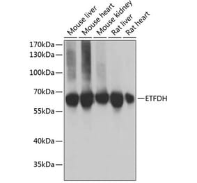 Western Blot - Anti-ETFDH Antibody (A9925) - Antibodies.com