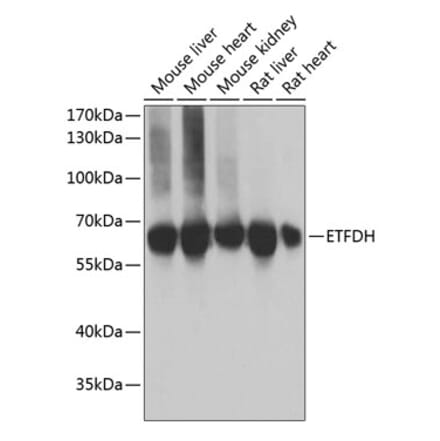Western Blot - Anti-ETFDH Antibody (A9925) - Antibodies.com