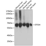 Western Blot - Anti-ETFDH Antibody (A9925) - Antibodies.com
