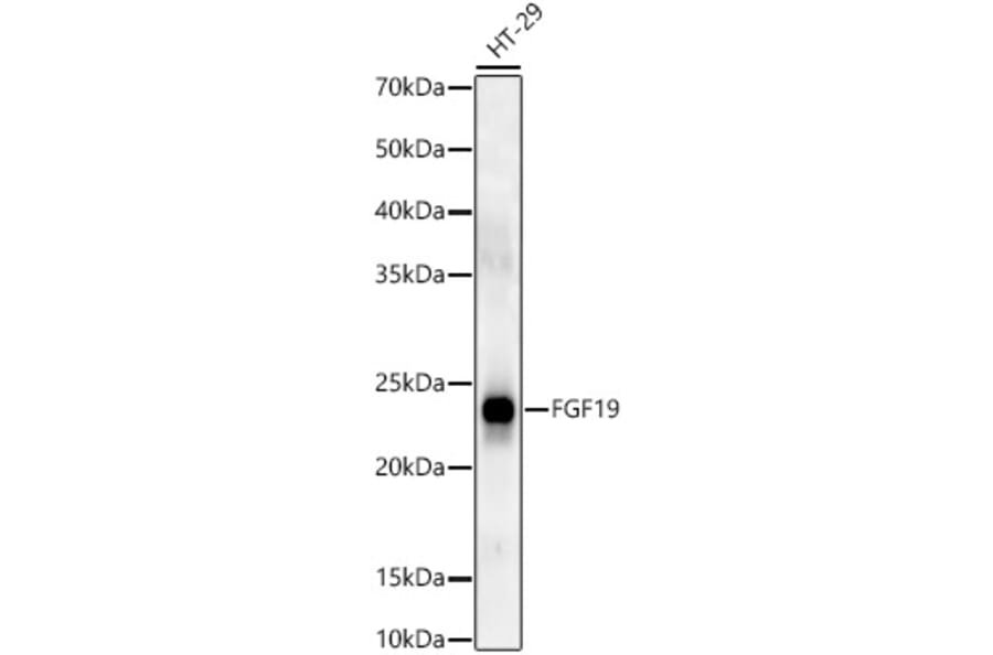 Western Blot - Anti-FGF19 Antibody (A9926) - Antibodies.com