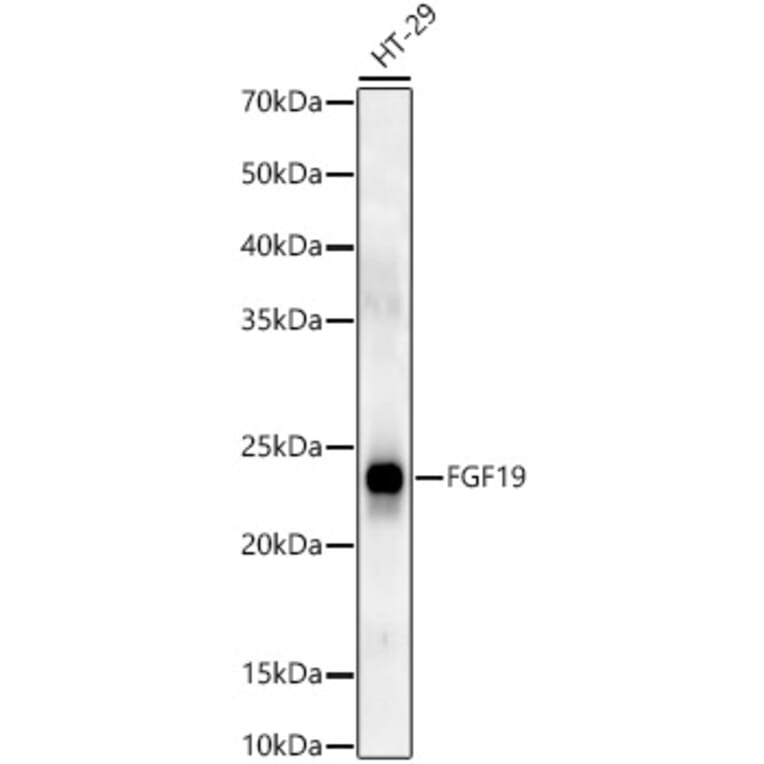 Western Blot - Anti-FGF19 Antibody (A9926) - Antibodies.com