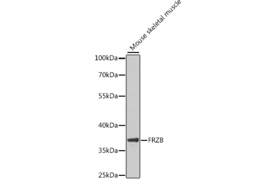 Western Blot - Anti-FRZB Antibody (A9927) - Antibodies.com