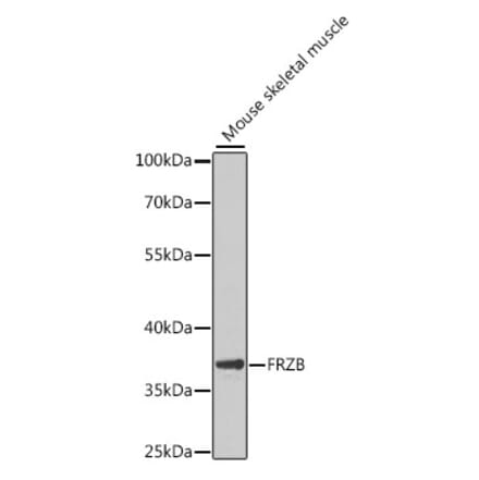 Western Blot - Anti-FRZB Antibody (A9927) - Antibodies.com