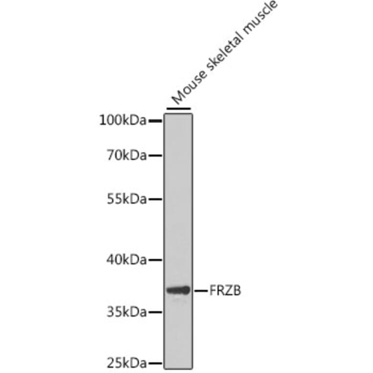 Western Blot - Anti-FRZB Antibody (A9927) - Antibodies.com
