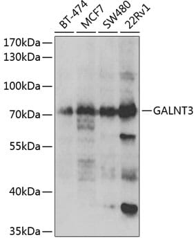 Western blot analysis of extracts of various cell lines, using Anti-GALNT3 Antibody (A6596) at 1:1,000 dilution.
Secondary antibody: Goat Anti-Rabbit IgG (H+L) (HRP) (AS014) at 1:10,000 dilution.
Lysates / proteins: 25µg per lane.
Blocking buffer: 3% non-fat dry milk in TBST.
Detection: ECL Basic Kit (RM00020).
Exposure time: 90s.
