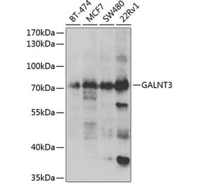 Western Blot - Anti-GALNT3 Antibody (A6596) - Antibodies.com