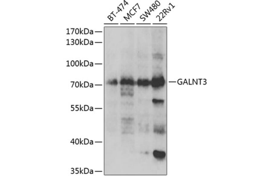 Western Blot - Anti-GALNT3 Antibody (A6596) - Antibodies.com