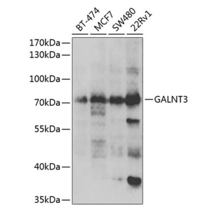 Western Blot - Anti-GALNT3 Antibody (A9929) - Antibodies.com