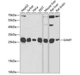 Western Blot - Anti-GAMT Antibody (A9930) - Antibodies.com
