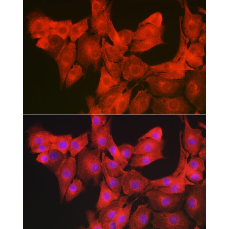 Immunofluorescence - Anti-GAMT Antibody (A9930) - Antibodies.com