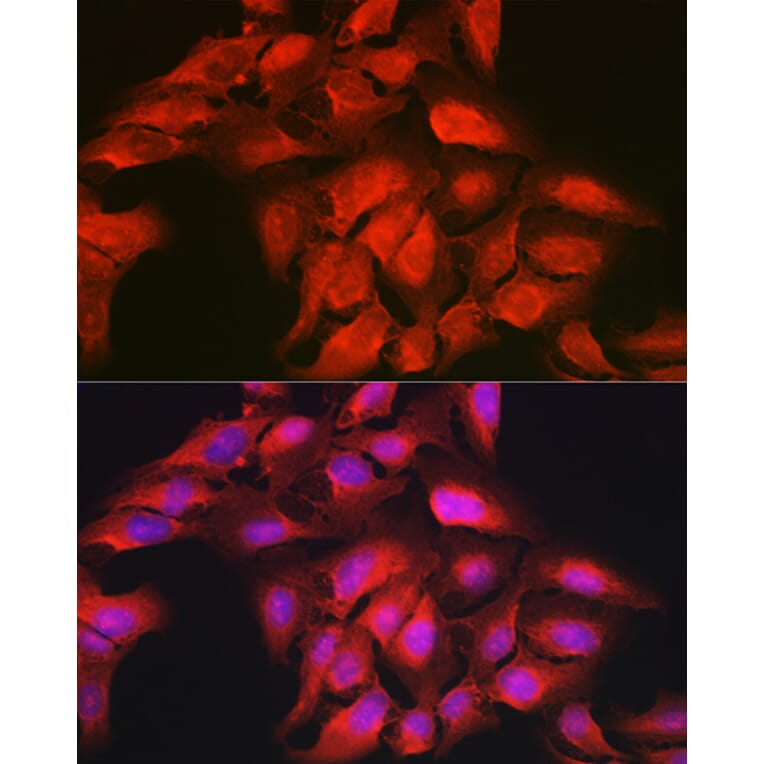 Immunofluorescence - Anti-GAMT Antibody (A9930) - Antibodies.com