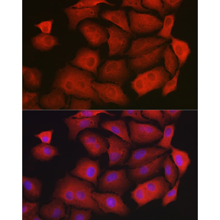 Immunofluorescence - Anti-GAMT Antibody (A9930) - Antibodies.com