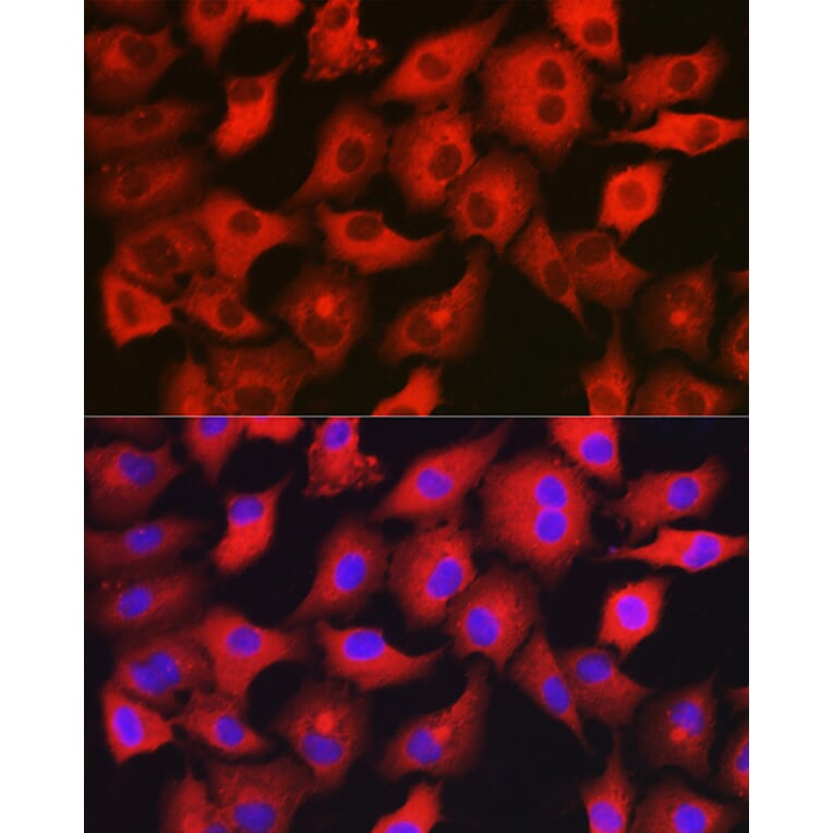 Immunofluorescence - Anti-GAMT Antibody (A9930) - Antibodies.com