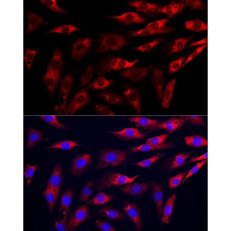 Immunofluorescence - Anti-GAMT Antibody (A9930) - Antibodies.com